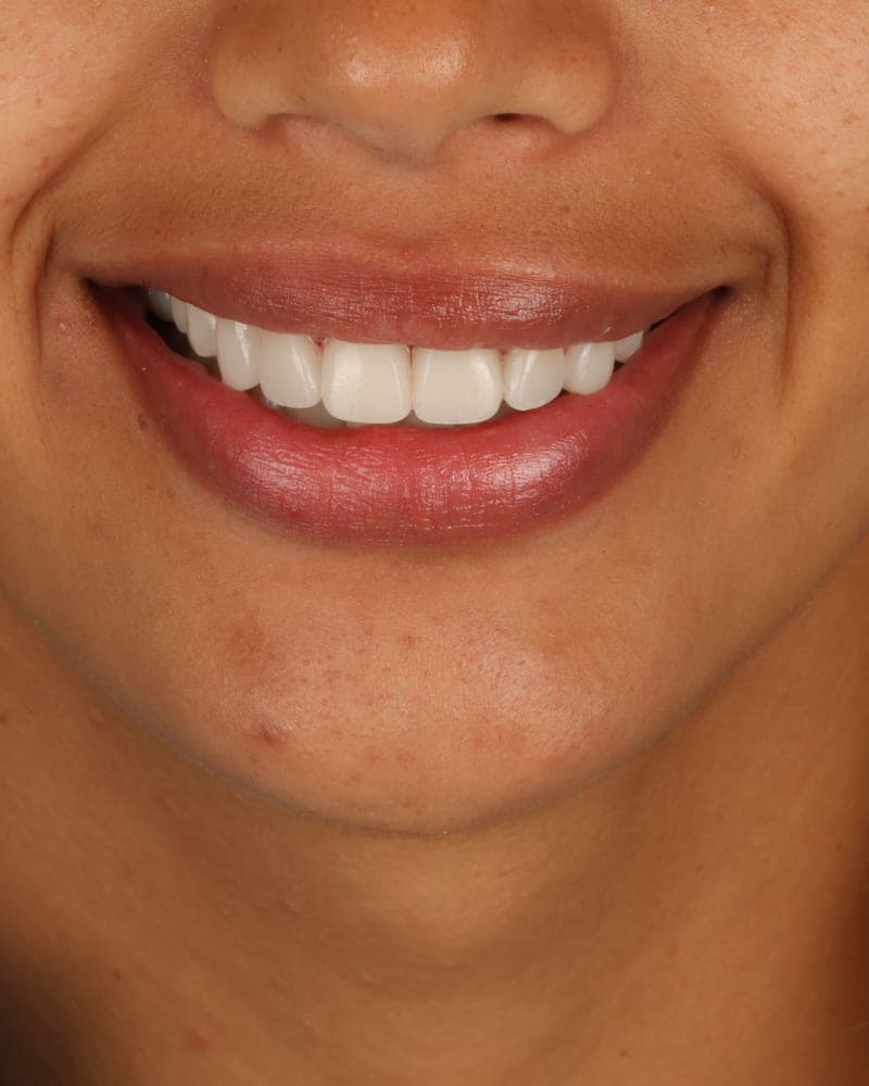 Smile treated at our practice