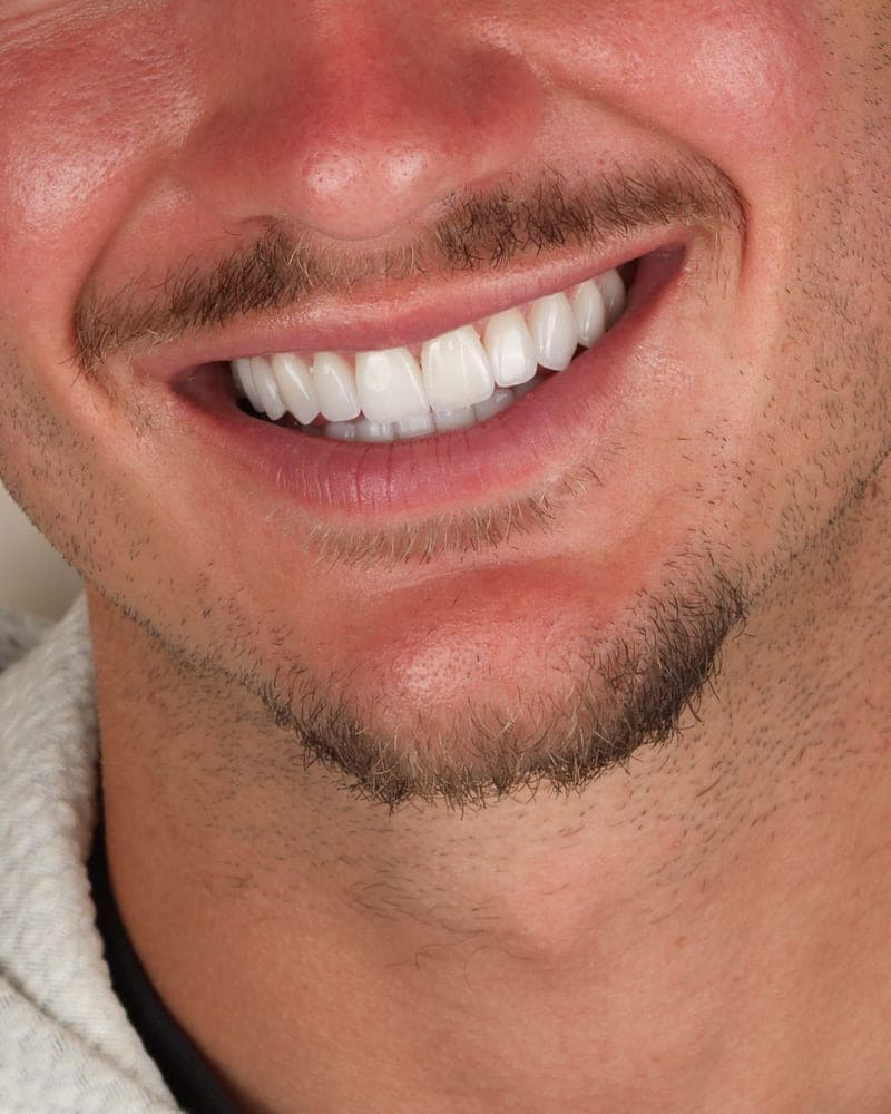 Smile treated at our practice