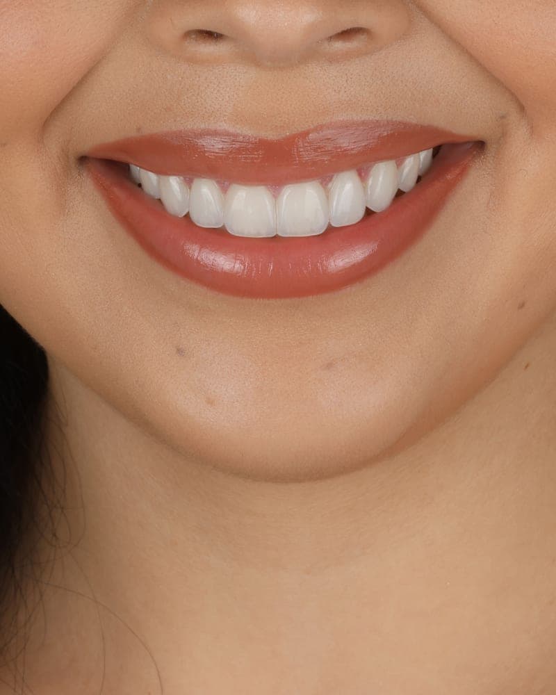 Smile treated at our practice