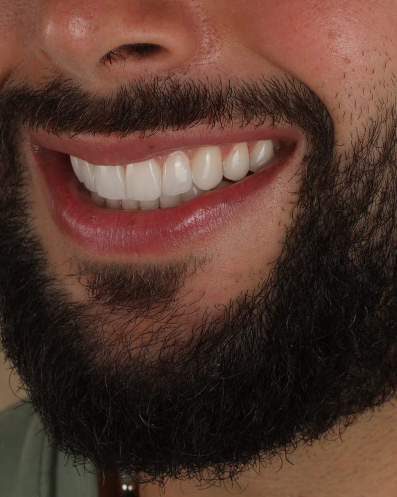 Smile treated at our practice