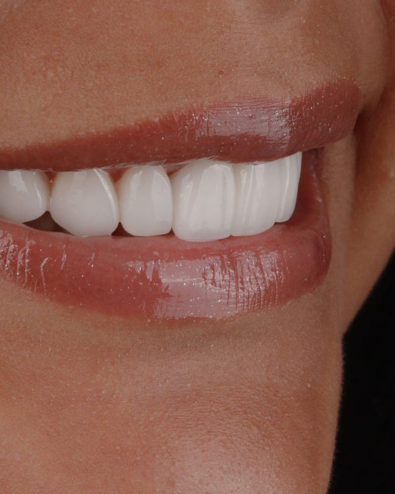 Smile treated at our practice