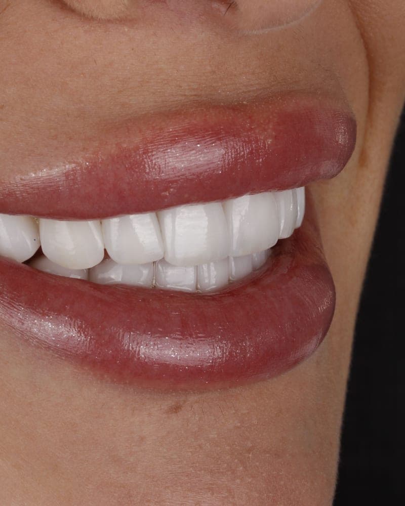 Smile treated at our practice