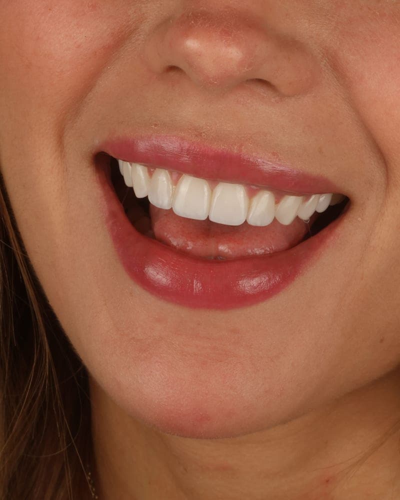 Smile treated at our practice
