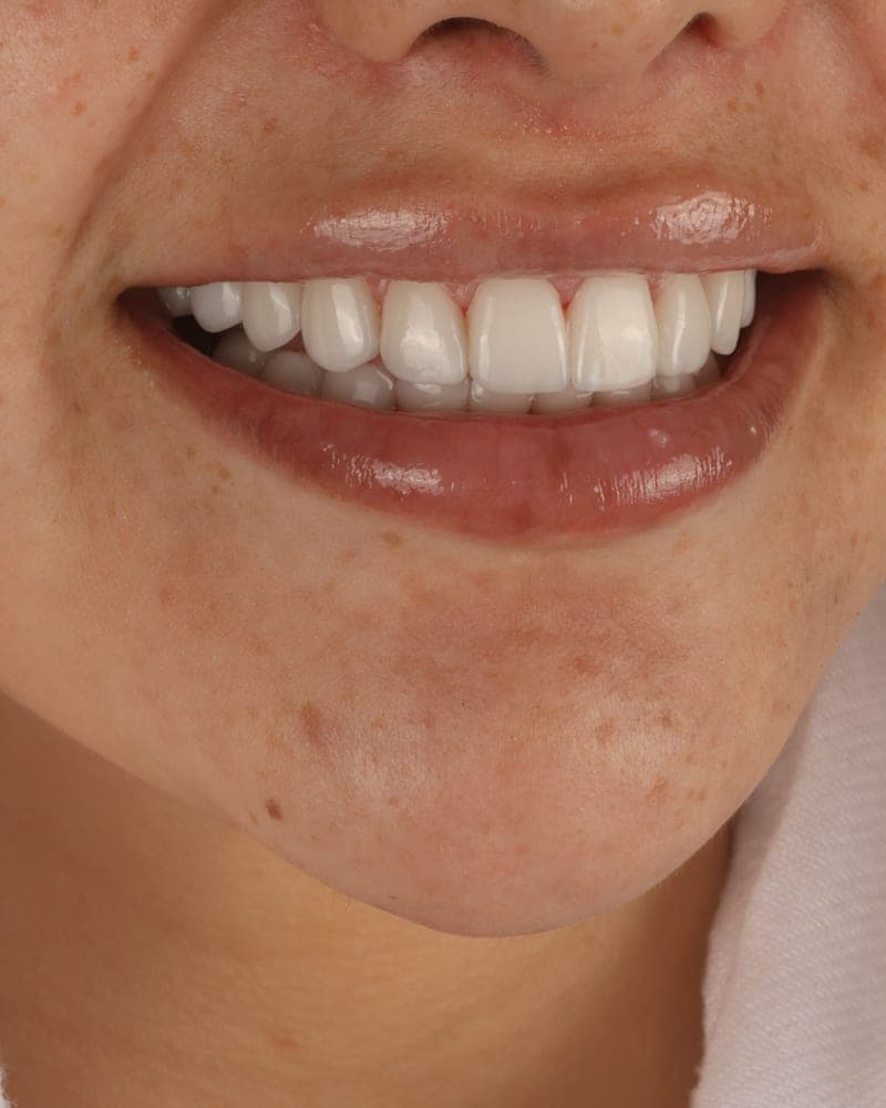 Smile treated at our practice