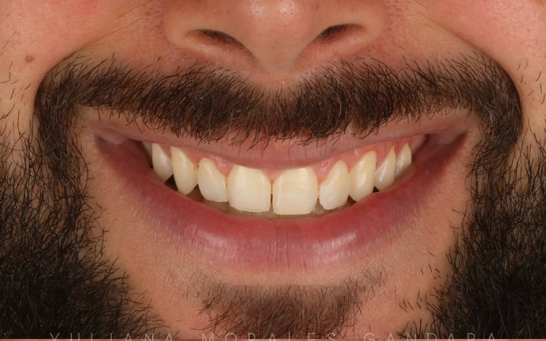 Case 2 — Before