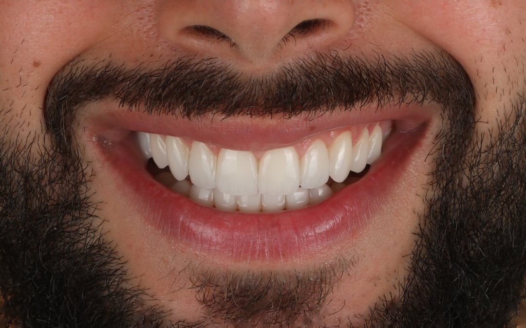 Case 2 — After