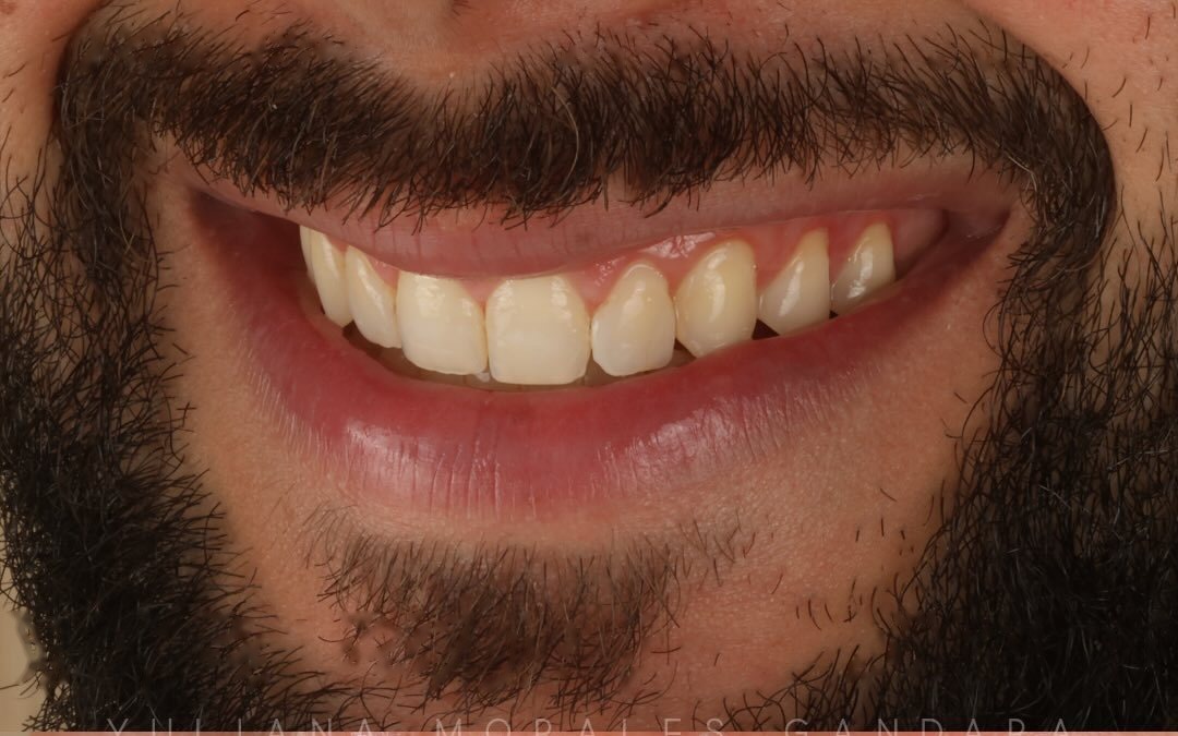 Case 3 — Before