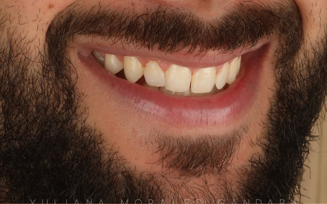 Case 4 — Before