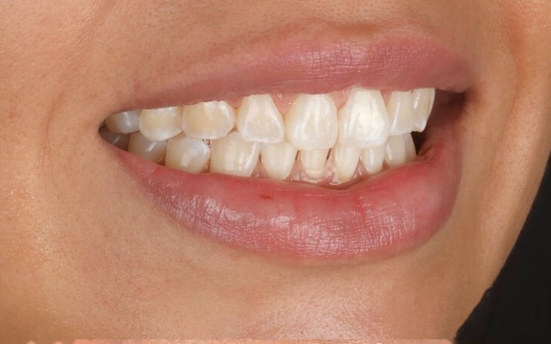 Case 5 — Before