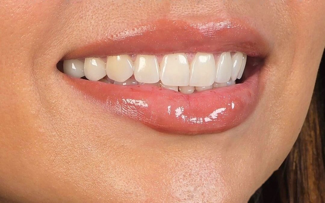 Case 5 — After