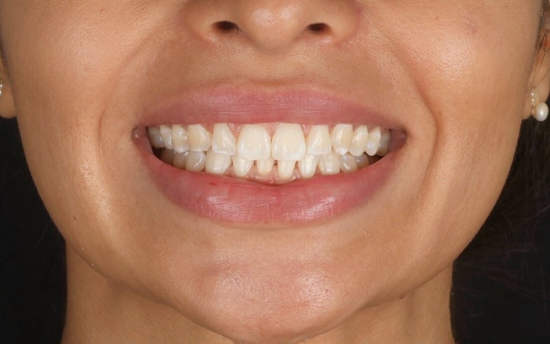 Case 6 — Before