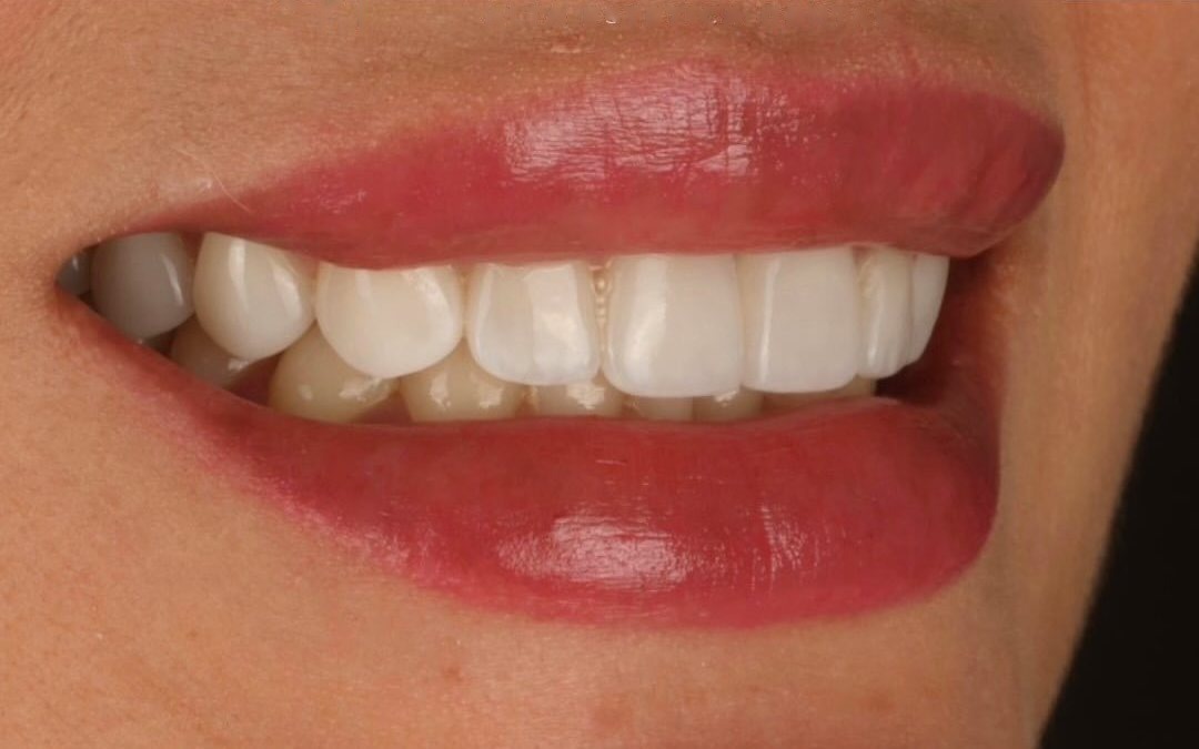 Case 8 — After