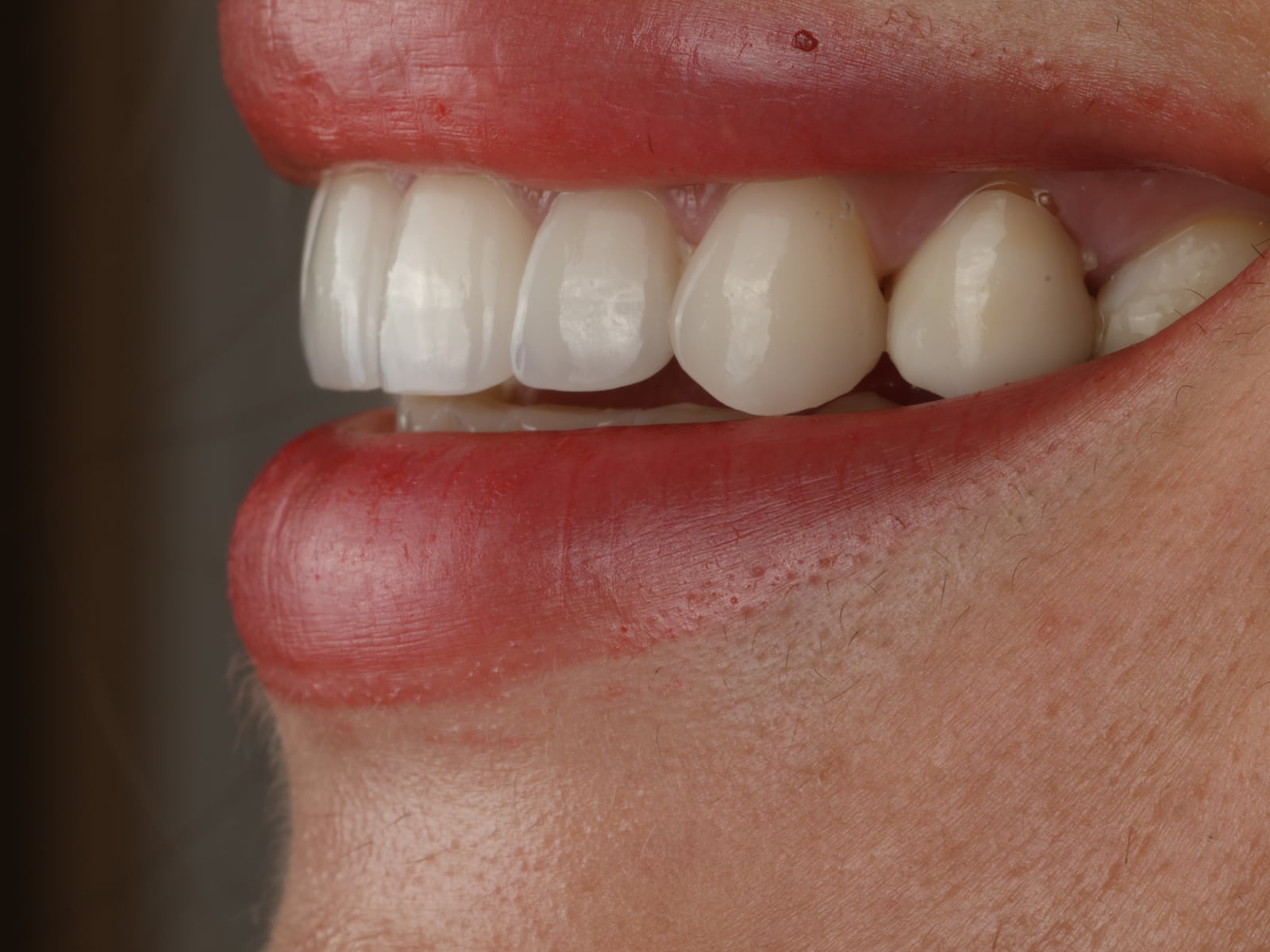 Case 9 — After